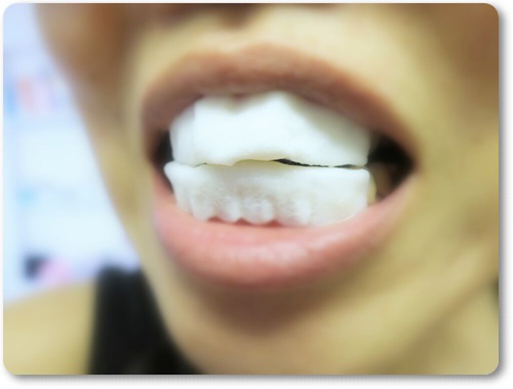 プレミアム ティースホワイトパック/Smile Cosmetique/その他オーラルケアを使ったクチコミ(3枚目)