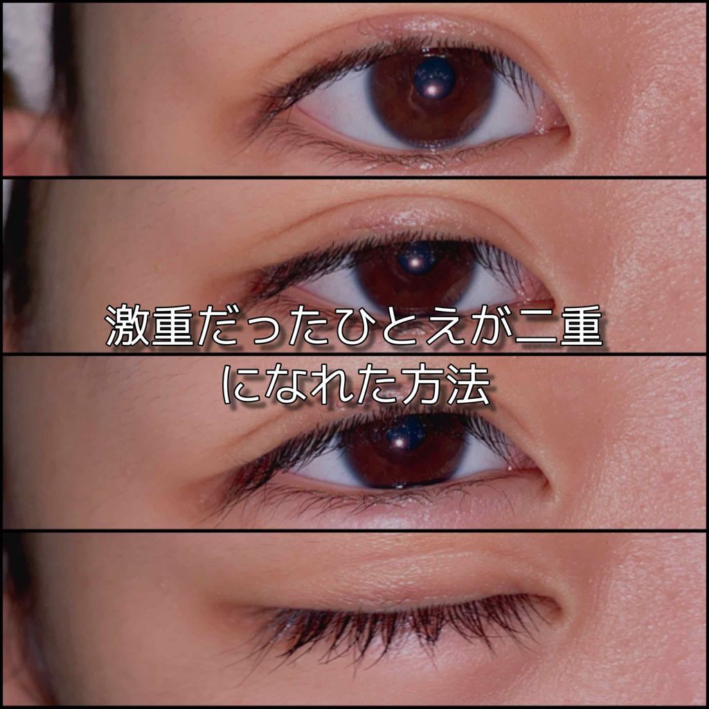 アイビューティー フィクサー WP/アストレア ヴィルゴ/二重まぶた用アイテムを使ったクチコミ（1枚目）