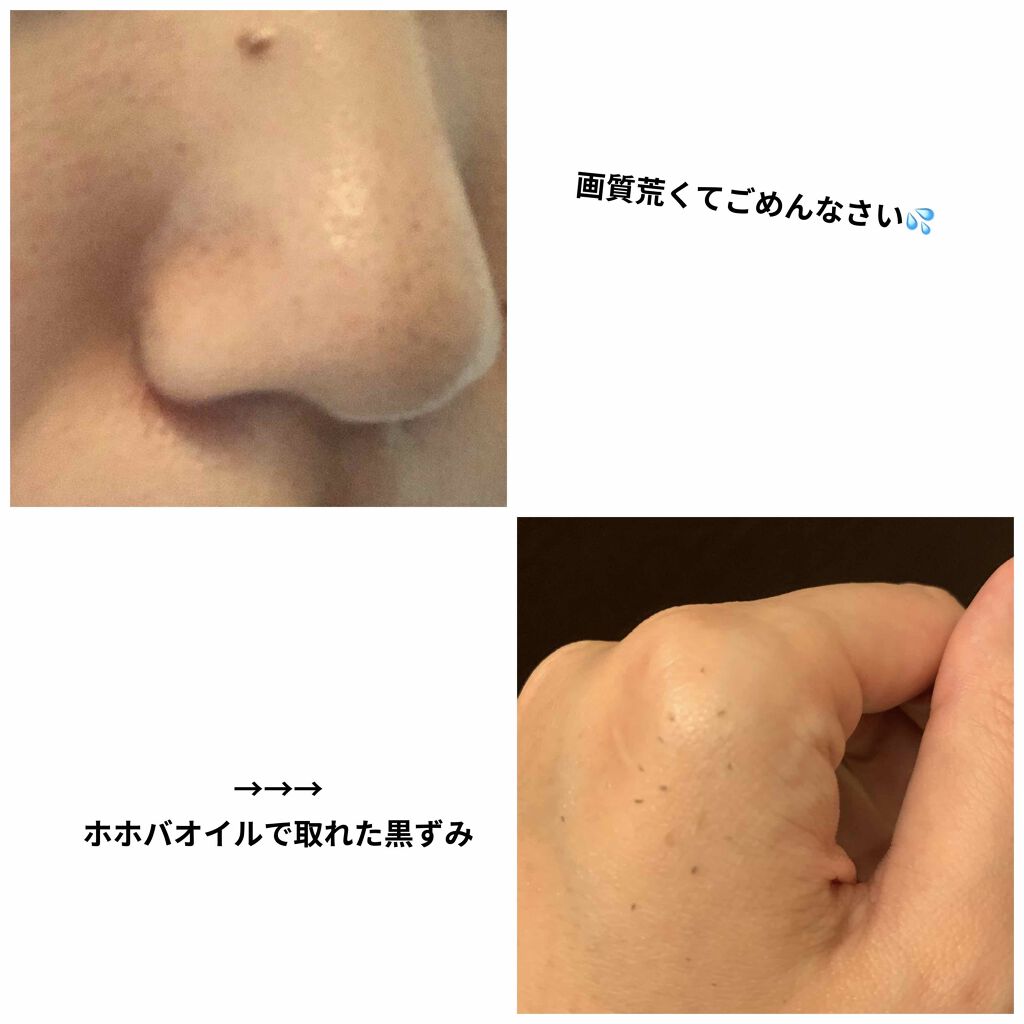 タカミスキンピール/タカミ/ブースター・導入液を使ったクチコミ（2枚目）