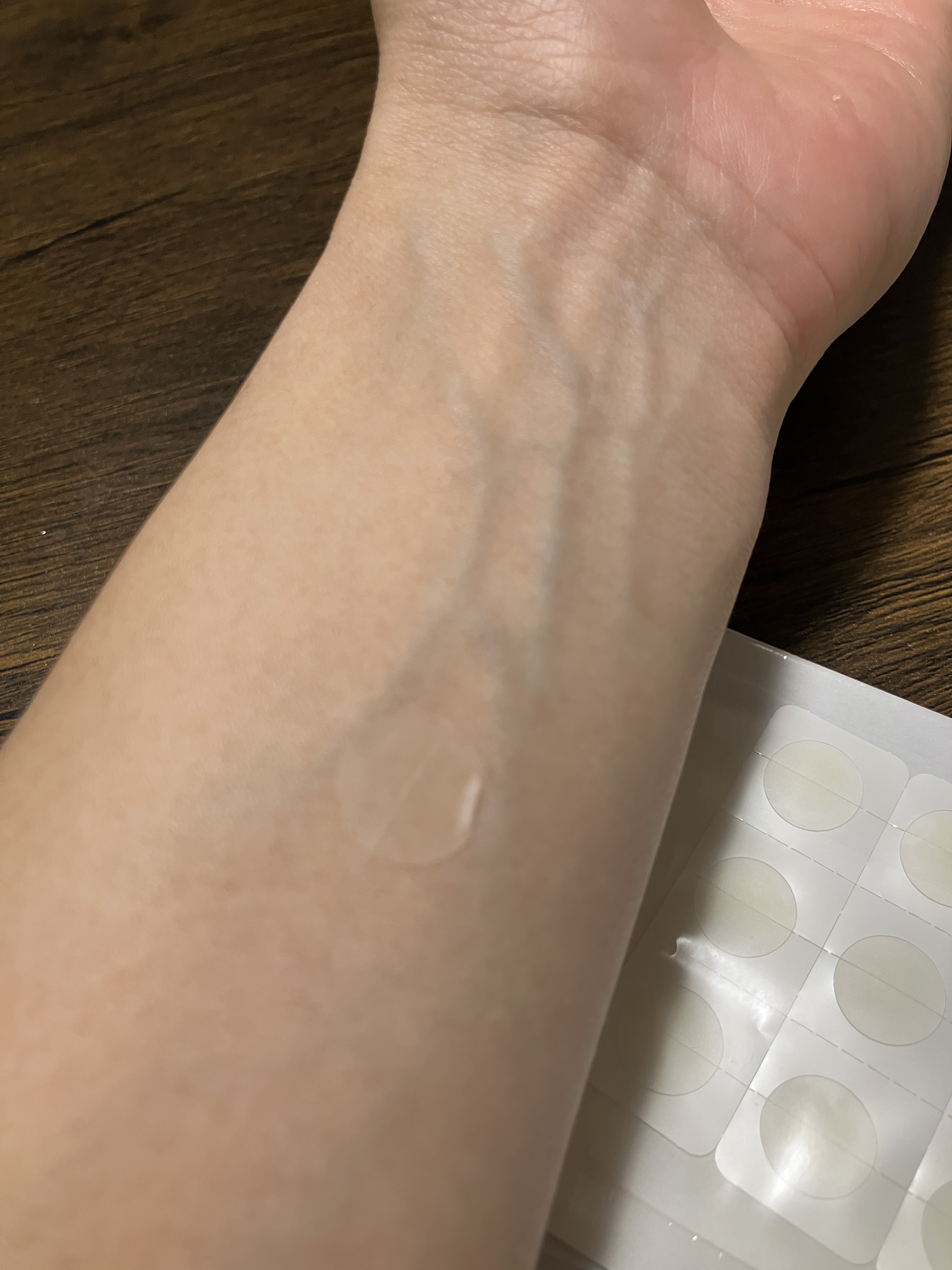 クリアパッチ/Angelab/にきびパッチを使ったクチコミ（3枚目）