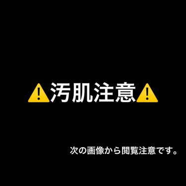 導入化粧液/無印良品/ブースター・導入液を使ったクチコミ（1枚目）