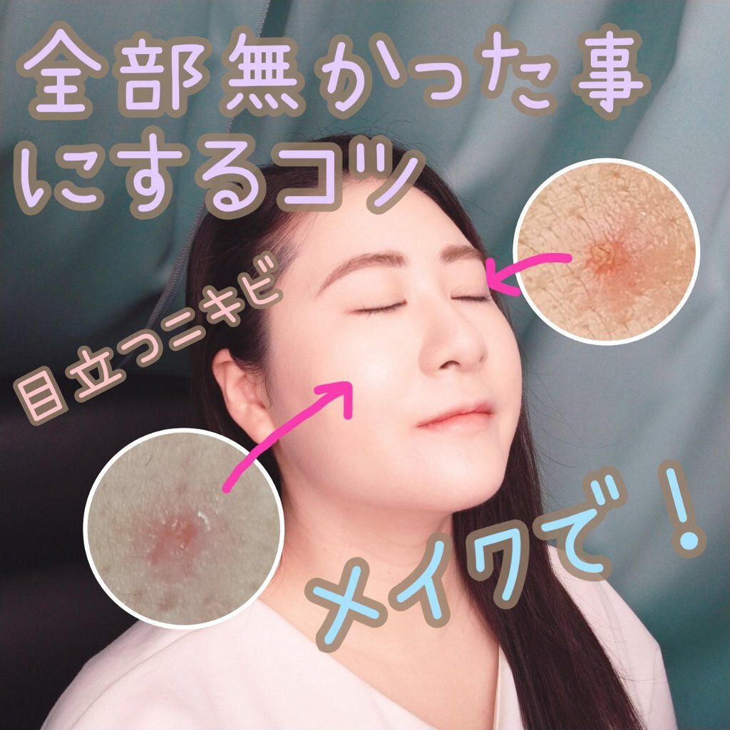 フローレス フィット/COVERMARK/クリーム・エマルジョンファンデーションを使ったクチコミ(1枚目)