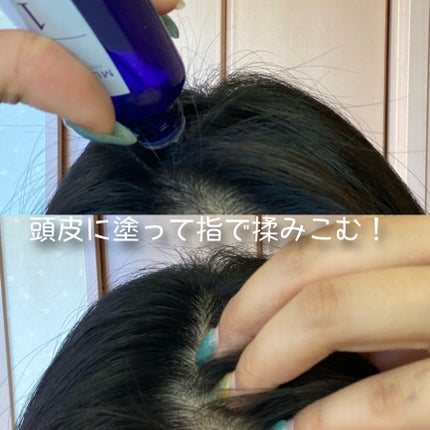 Wアプローチヘアプログラム/MUNOAGE(ミューノアージュ)/頭皮ローションを使ったクチコミ(5枚目)