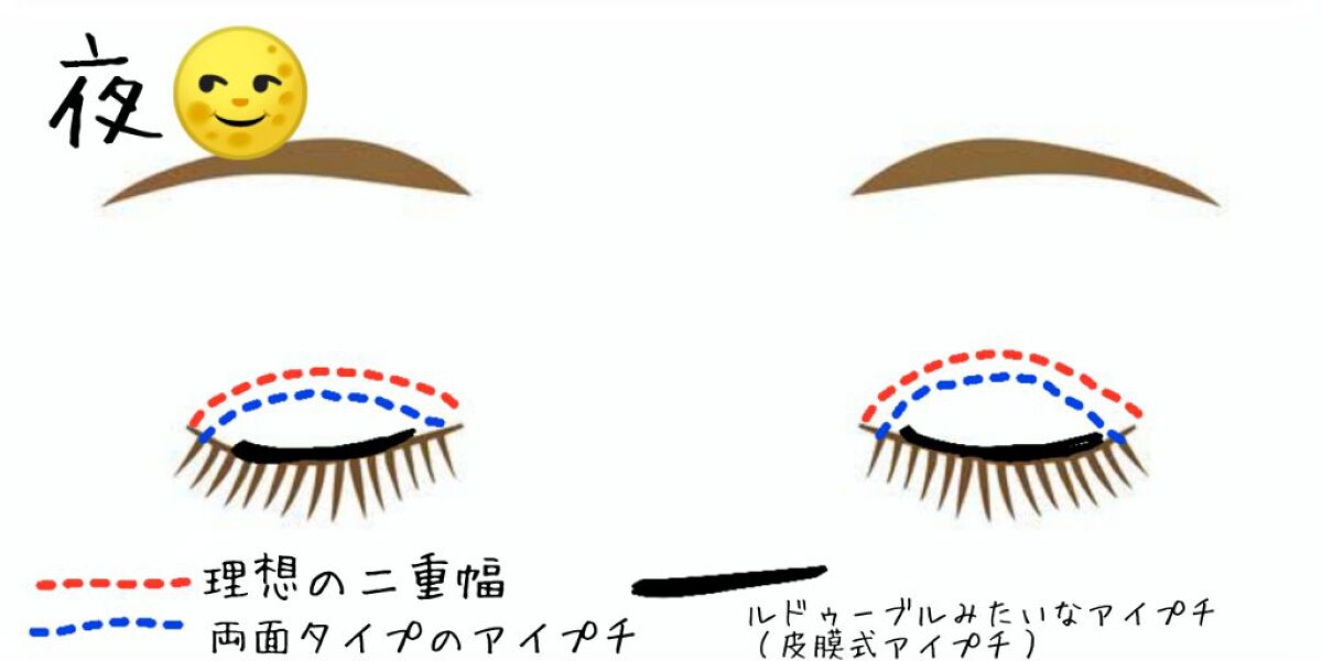 のび〜る アイテープ 両面テープタイプ/DAISO/二重まぶた用アイテムを使ったクチコミ（2枚目）