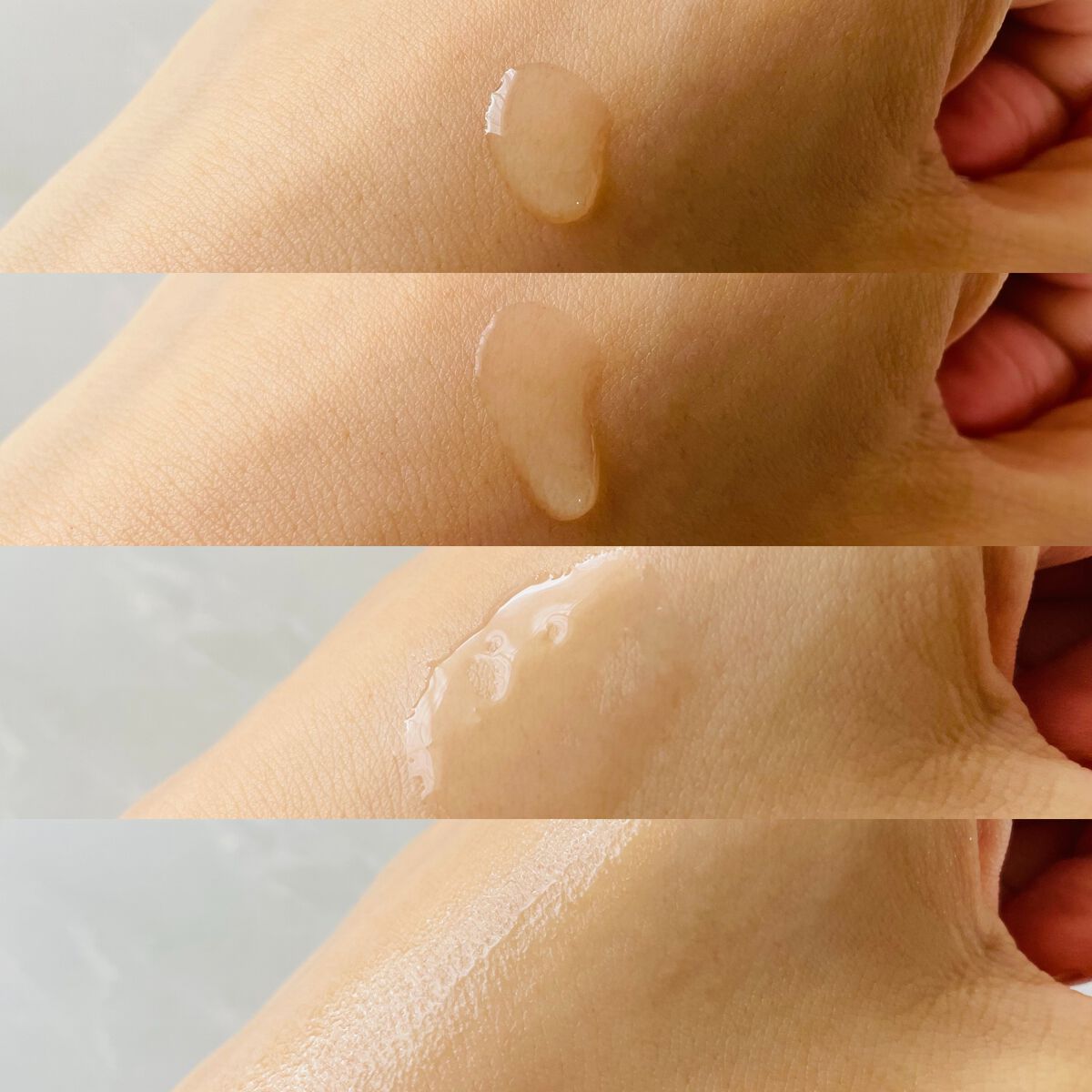 ダーマレーザー ウルセラC/クオリティファースト/美容液を使ったクチコミ（3枚目）