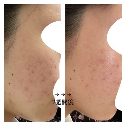 㪠㪠ð§žâ¡ on LIPS ããããæ¥èš6é±éç®2021/03/18ææŽé¡æããŒãããã¹ã¿é..ãïŒ5æç®ïŒ