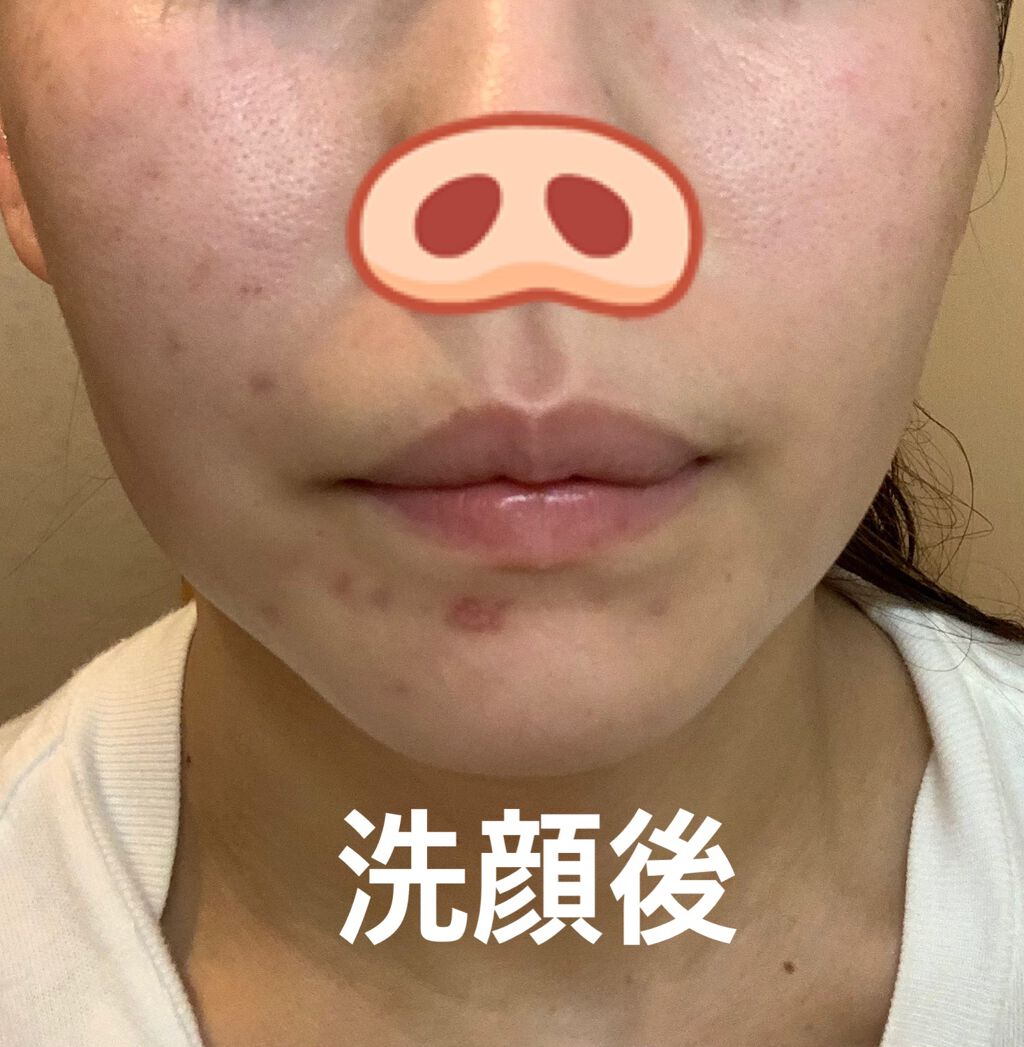 CICA カプセルマスク/VT/洗い流すパック・マスクを使ったクチコミ(2枚目)