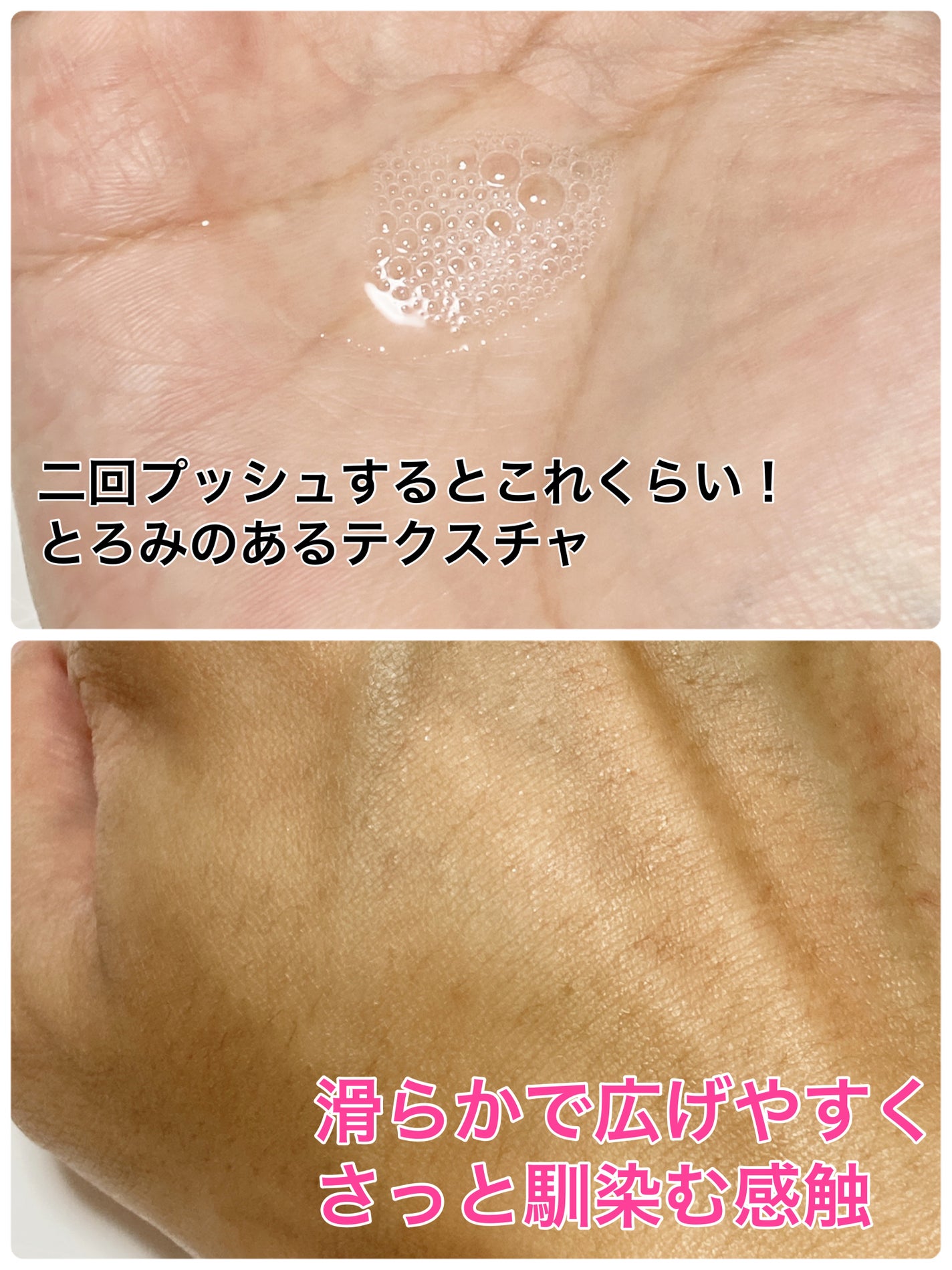 モイストケア ローション MB/d プログラム/化粧水を使ったクチコミ(2枚目)