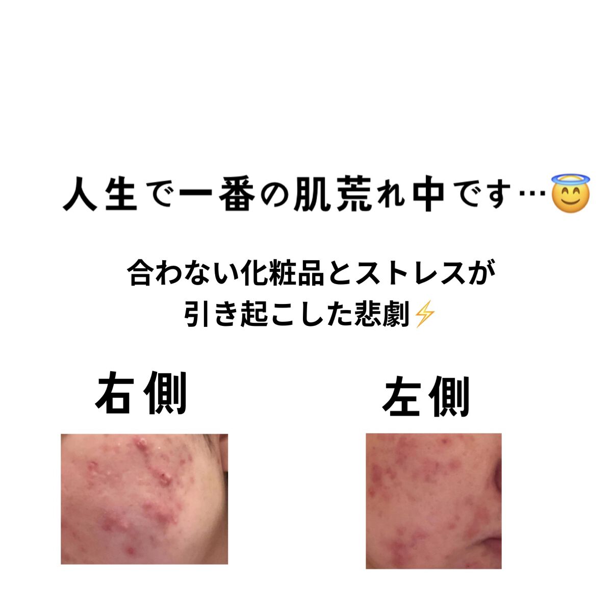 スキンコンディショナー高保湿/CEZANNE/化粧水を使ったクチコミ（1枚目）