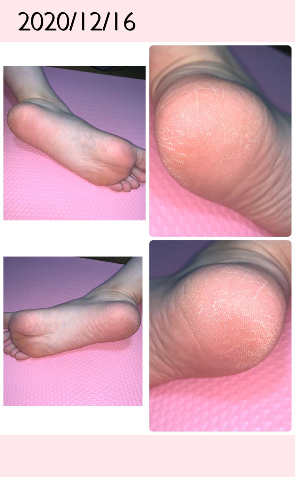 オルビス ディフェンセラ/オルビス/美容サプリメントを使ったクチコミ（3枚目）