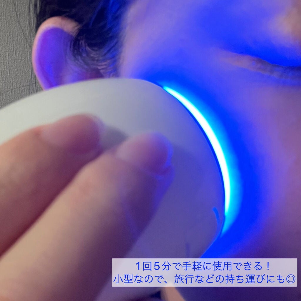 リファビューテック スポット/ReFa/美顔器・マッサージを使ったクチコミ(4枚目)