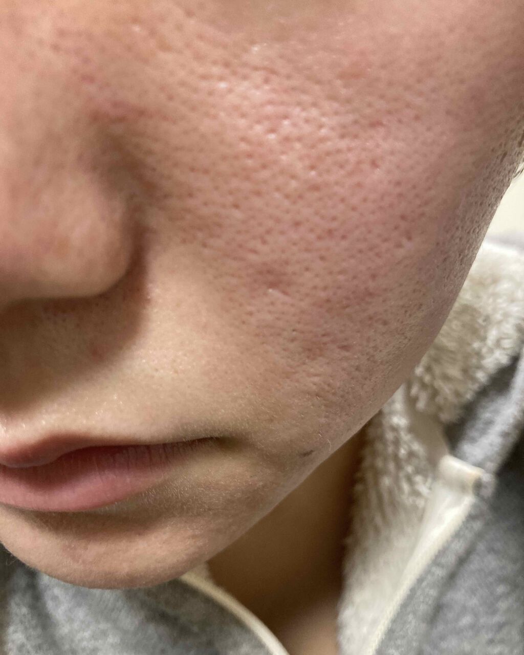 オバジC10セラム/オバジ/美容液を使ったクチコミ（3枚目）