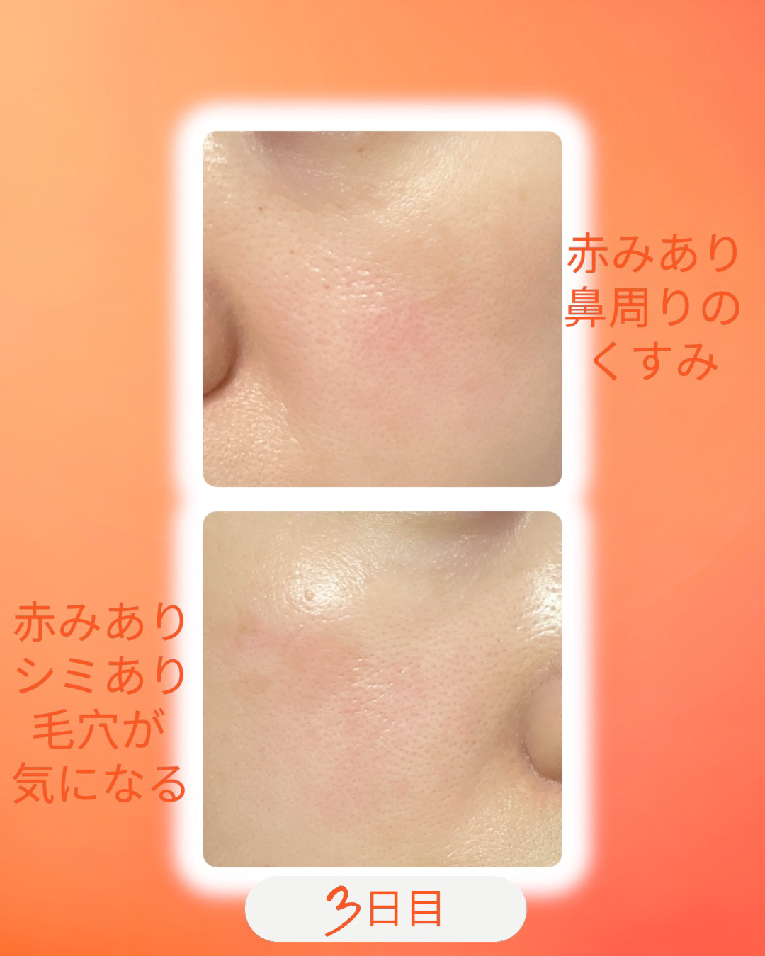 TXトーニングデイリーマスク/VT/その他スキンケアを使ったクチコミ（2枚目）