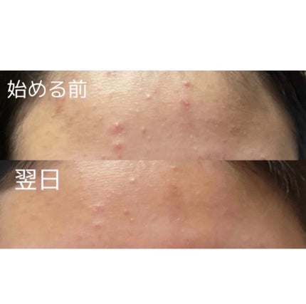 美白美容液 VC/ちふれ/美容液を使ったクチコミ(2枚目)