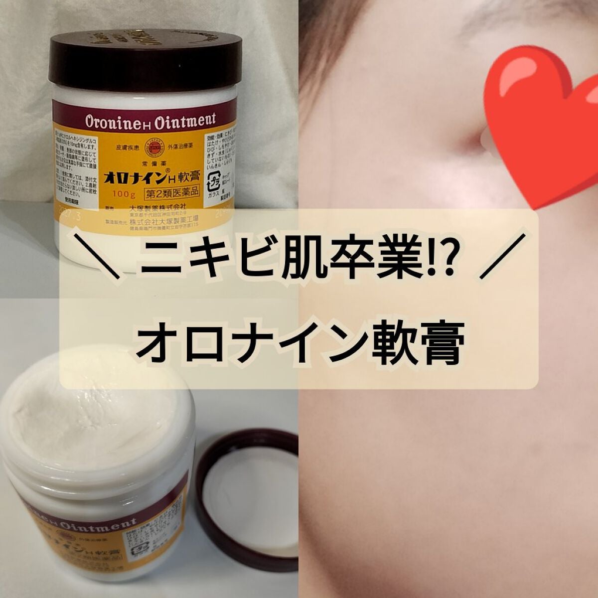 オロナインH軟膏 (医薬品)/オロナイン/その他を使ったクチコミ(1枚目)