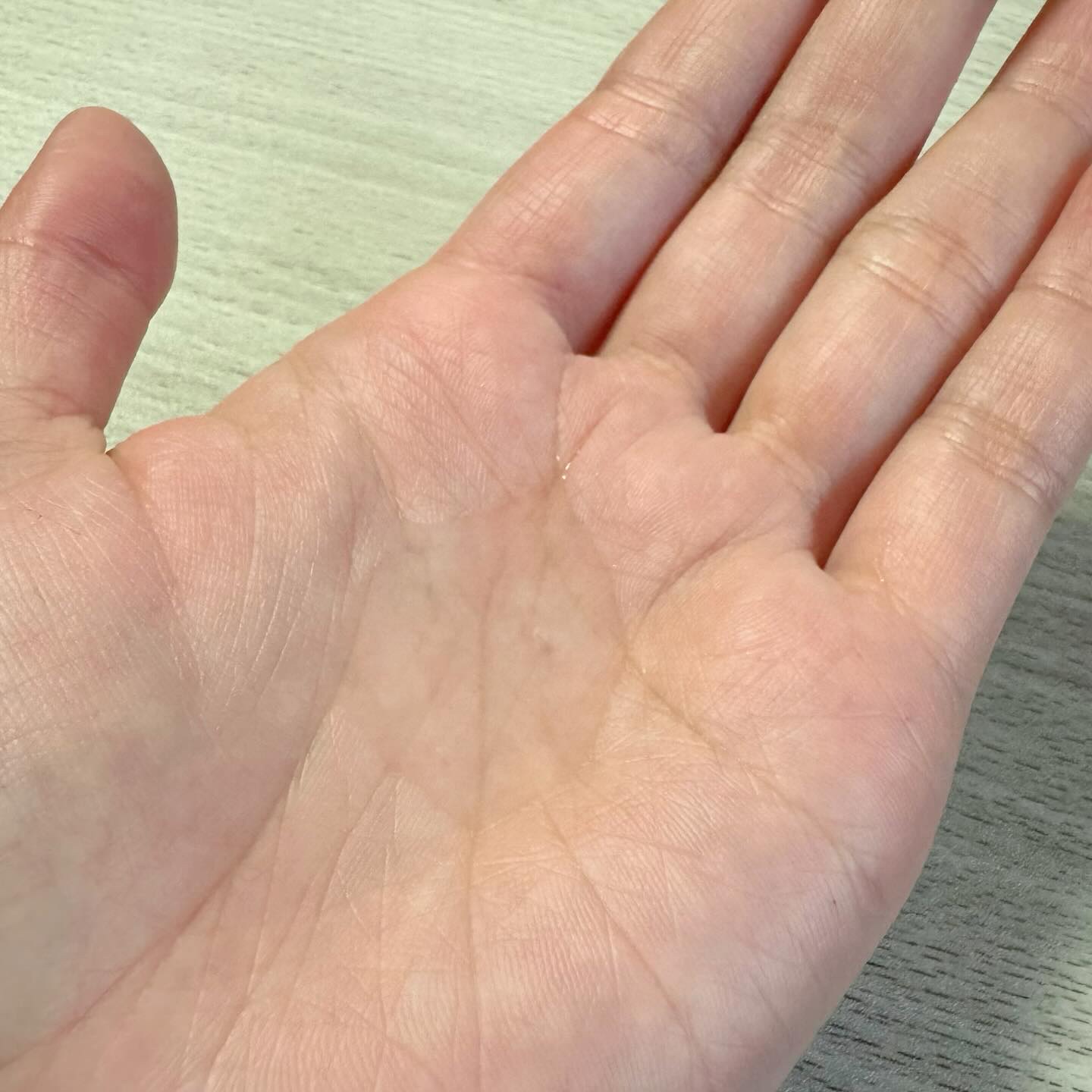 ブラックライス ヒアルロニックトナー/haruharu wonder/化粧水を使ったクチコミ（3枚目）