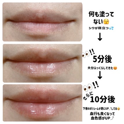 ドトムリッププラスプランパー/keybo/リッププランパーを使ったクチコミ(5枚目)