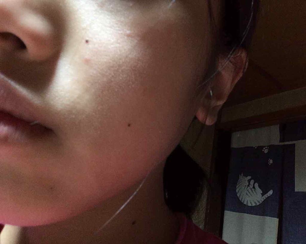 なっち on LIPS 「雑談私はアトピーで、すぐに小さなぶつぶつができます。..」(1枚目)