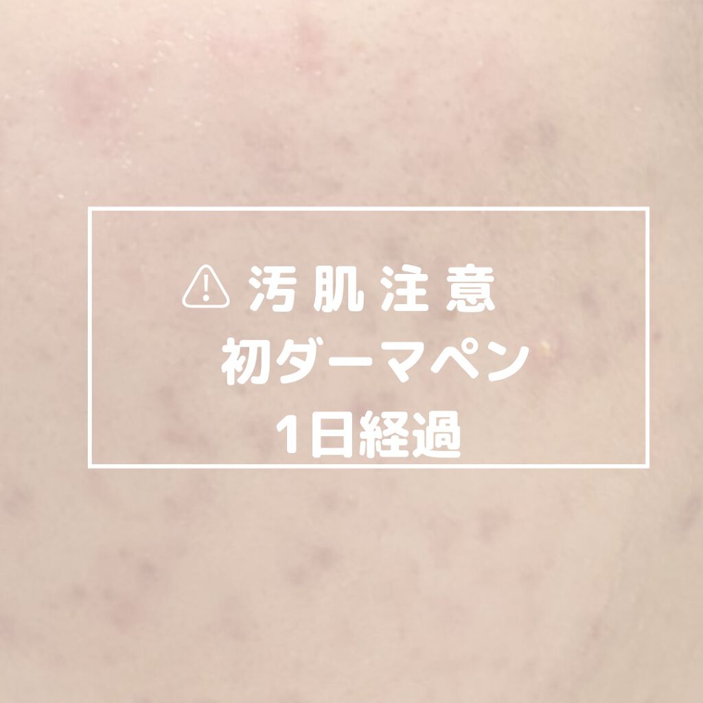 を使ったクチコミ（1枚目）