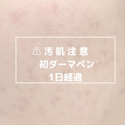 を使ったクチコミ(1枚目)