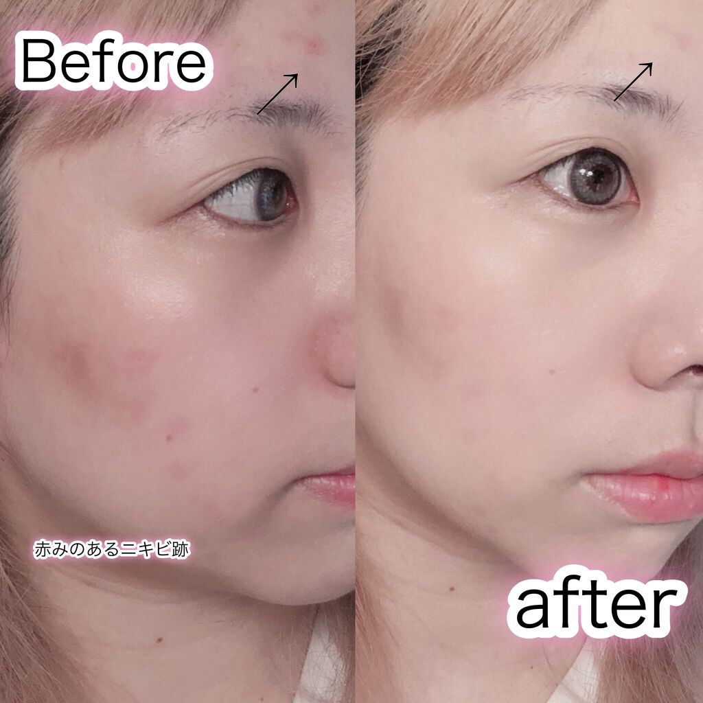 エアクッション カバー/IOPE/クッションファンデーションを使ったクチコミ(3枚目)