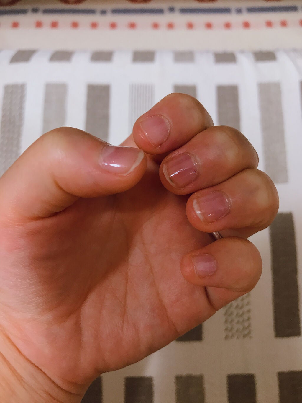 やんちー on LIPS 「しばらくぶりの更新です。育爪を初めて半年ほど…一進一退を繰り返..」(1枚目)