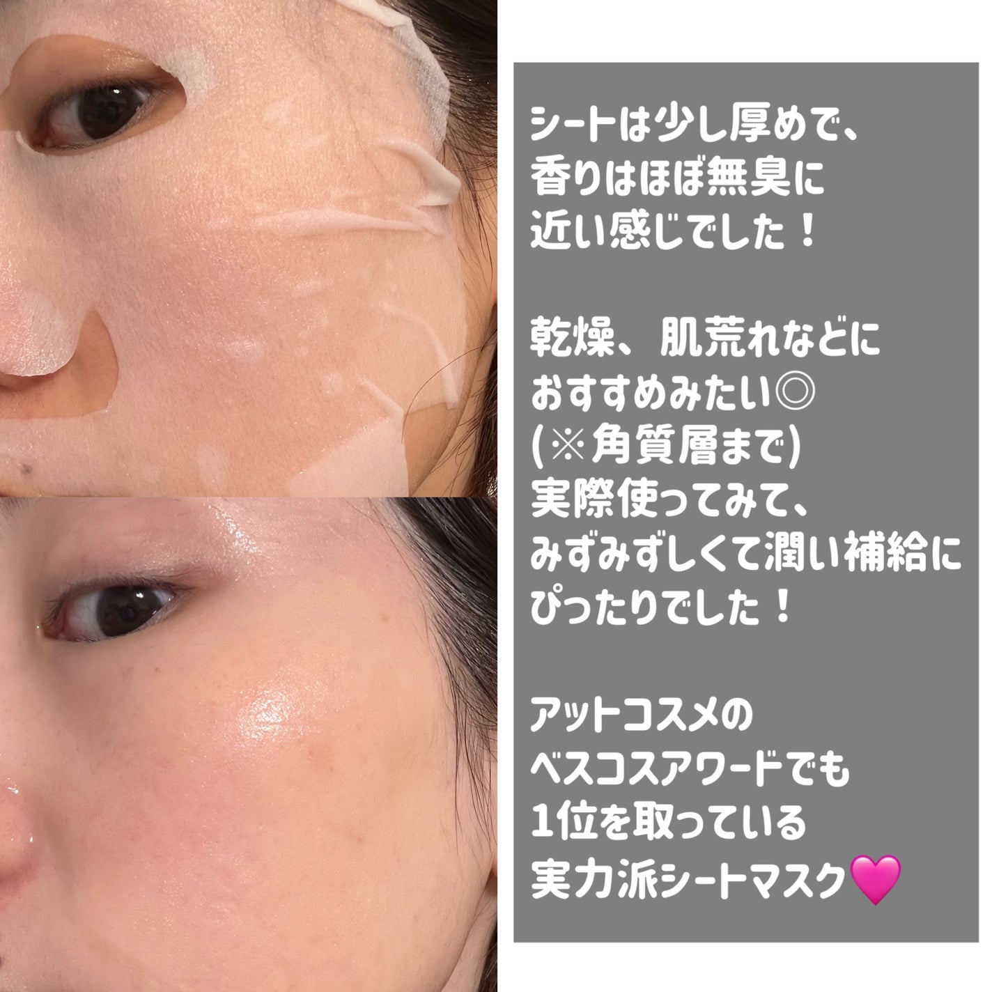 ルルルンピュア エブリーズ/ルルルン/シートマスク・パックを使ったクチコミ(2枚目)