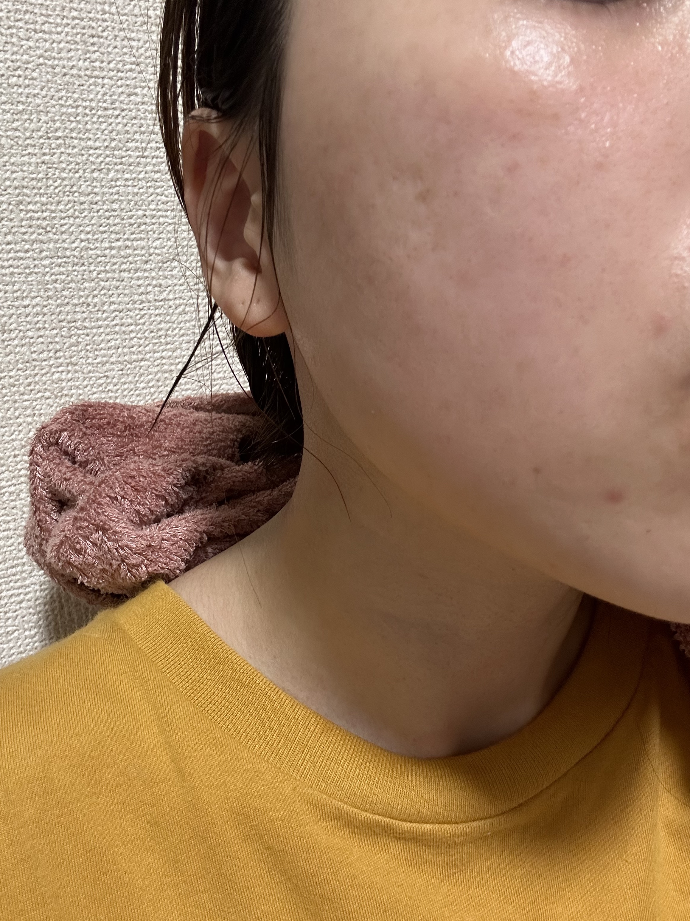 グーダルHCトナーパッド /goodal/トナーパッドを使ったクチコミ（2枚目）