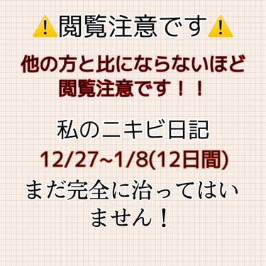 無印良品 敏感肌用薬用美白美容液のクチコミ「お久しぶりです!!

高校1年生(16の私のニキビ日記Part2でございます!!

12/17.....」（1枚目）