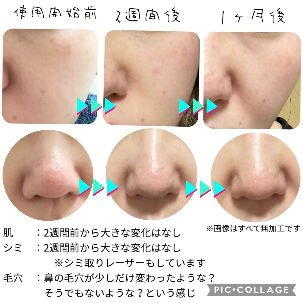 V エッセンス/unlabel/美容液を使ったクチコミ(2枚目)