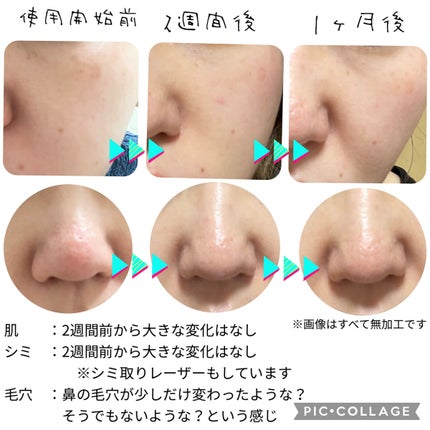 V エッセンス/unlabel/美容液を使ったクチコミ(2枚目)