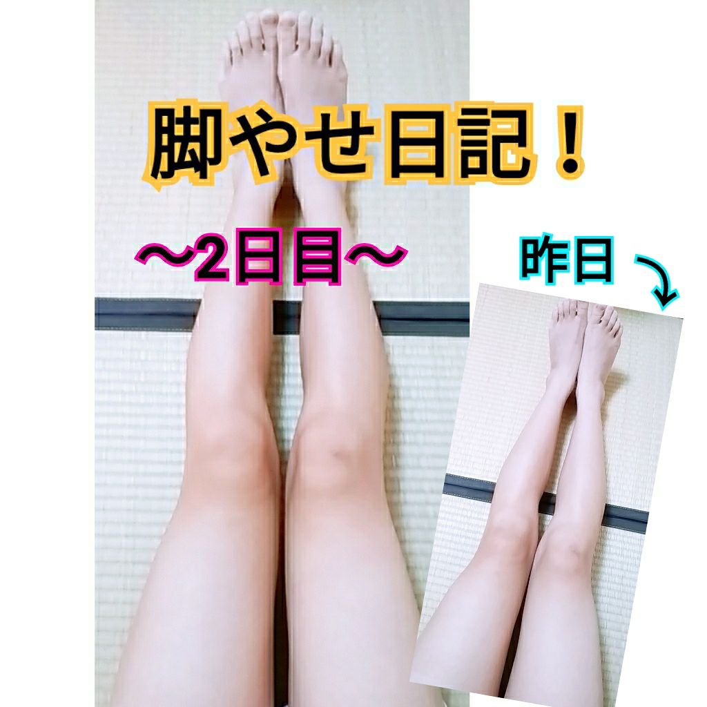 メディソックスナイト/ラブリーラボ/着圧ソックス・レギンスを使ったクチコミ（1枚目）