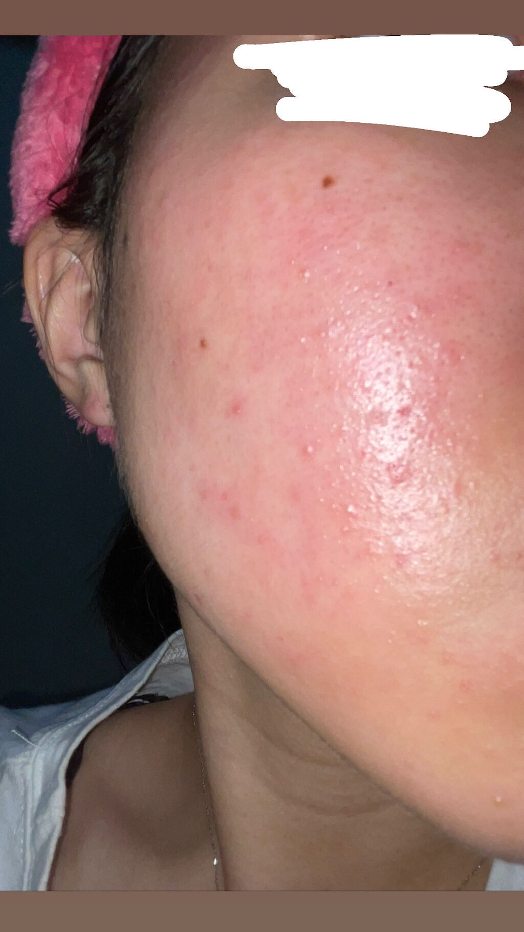 とろんと濃ジェル 薬用美白 N/なめらか本舗/オールインワン化粧品を使ったクチコミ（1枚目）