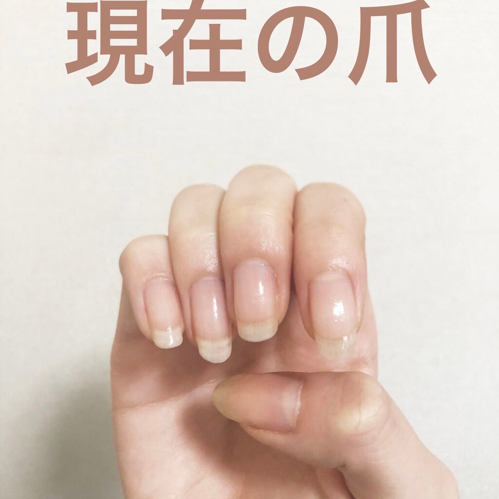 ネイルエンビー/O・P・I/ネイルオイル・トリートメントを使ったクチコミ(4枚目)