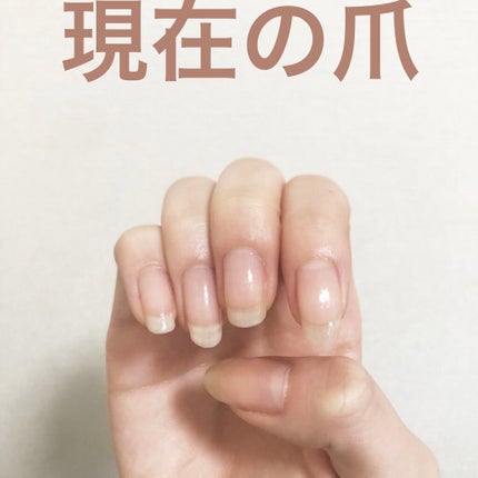 ネイルエンビー/O・P・I/ネイルオイル・トリートメントを使ったクチコミ(4枚目)