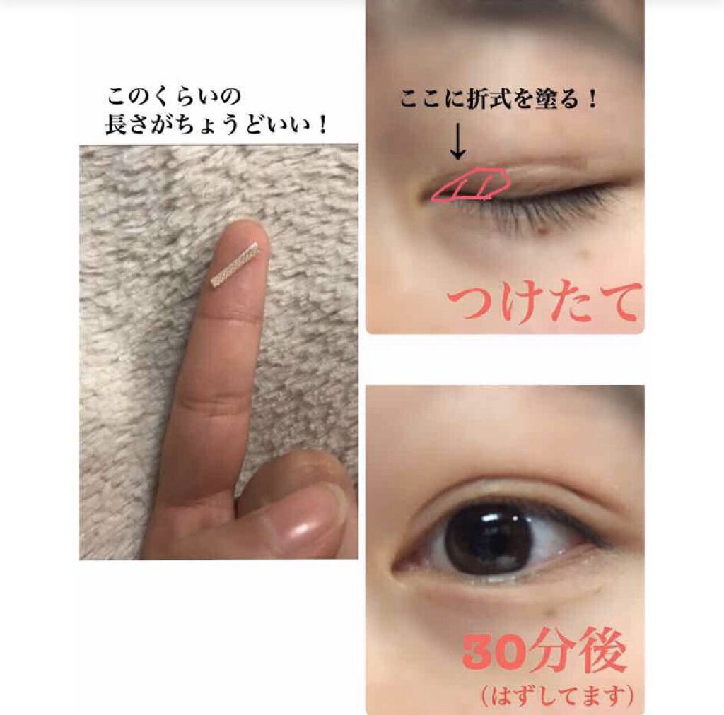 肌色タイプ/バンドエイド/その他を使ったクチコミ（3枚目）