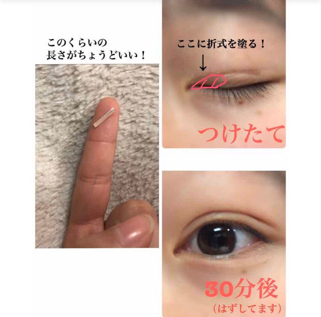 肌色タイプ/バンドエイド/その他を使ったクチコミ(3枚目)