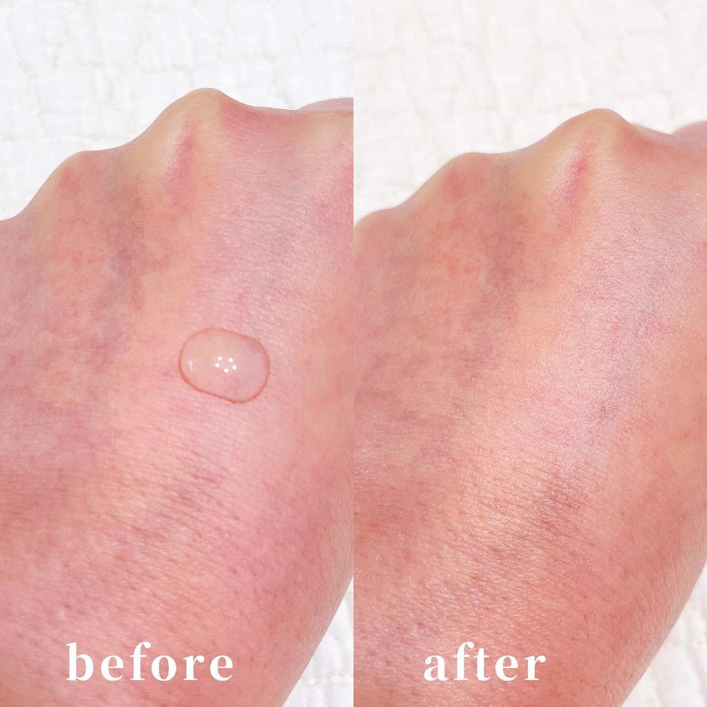 グルカミューンクリーム/VT/フェイスクリームを使ったクチコミ（2枚目）