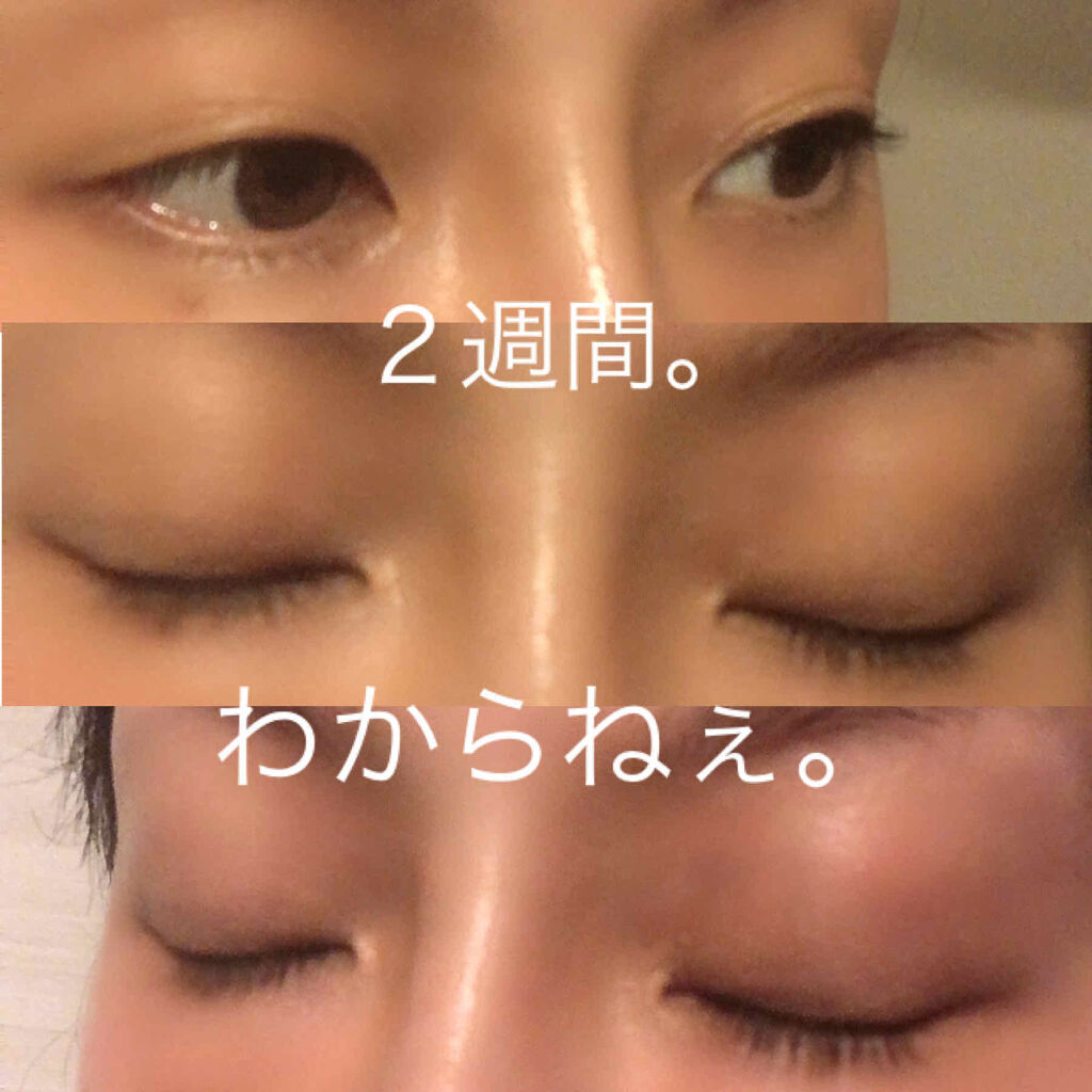 マツゲノミカタ/MIKATA/まつげ美容液を使ったクチコミ（3枚目）