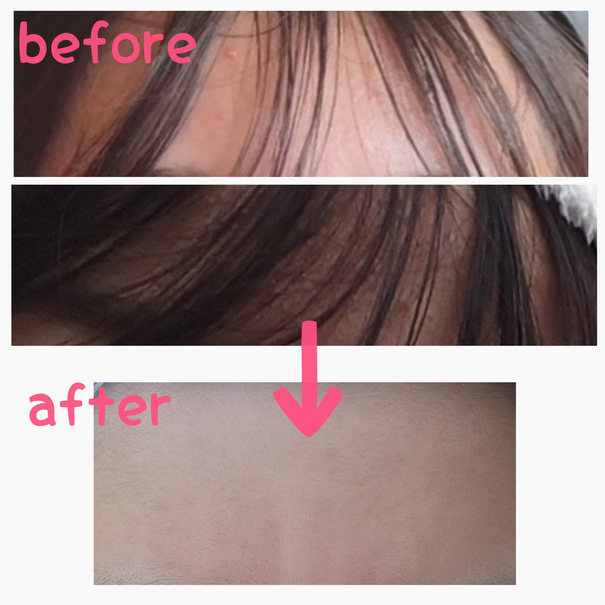 シカレチA エッセンス0.1/VT/美容液を使ったクチコミ（2枚目）