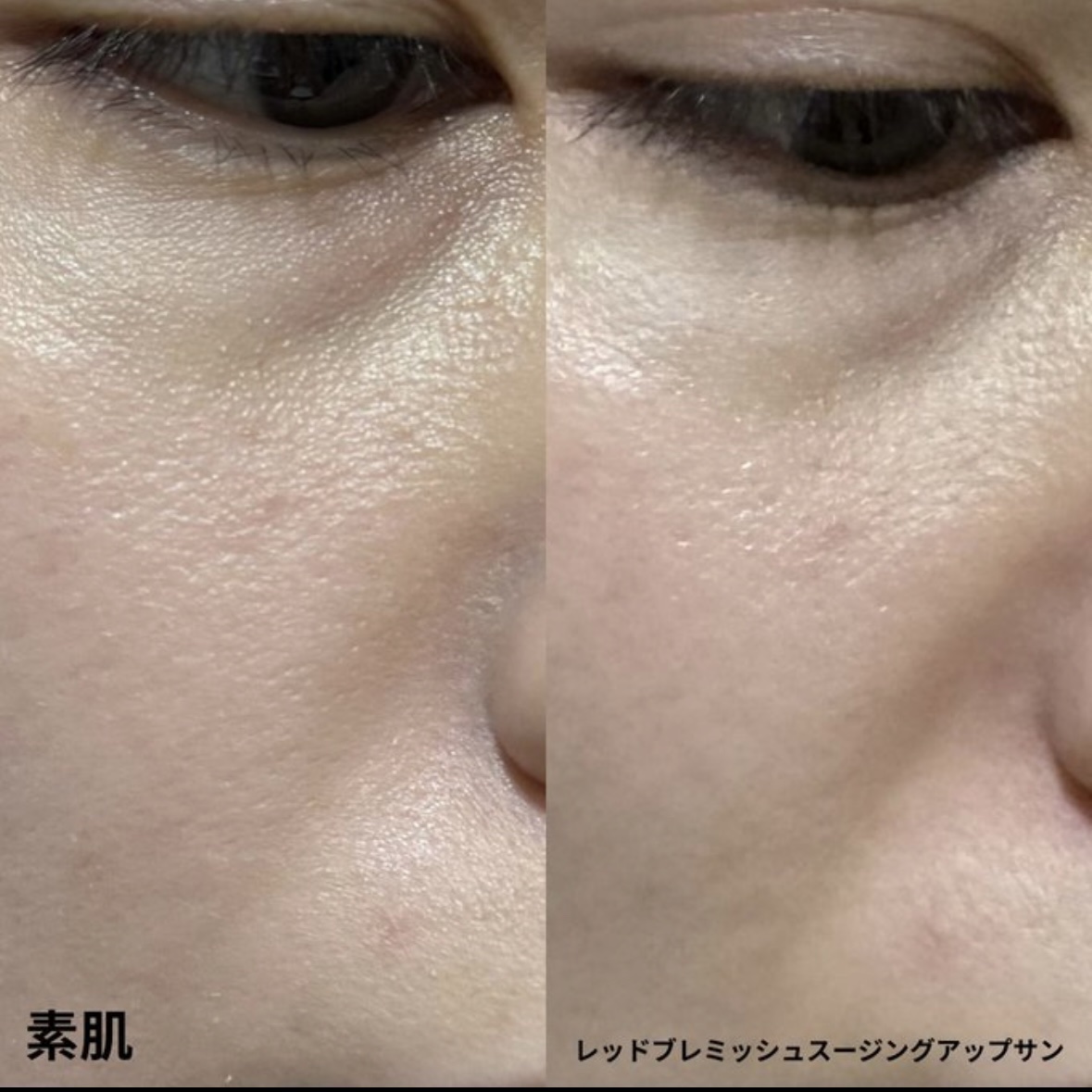 レッドブレミッシュスージングアップサン 35ml/Dr.G/日焼け止めクリームを使ったクチコミ（2枚目）