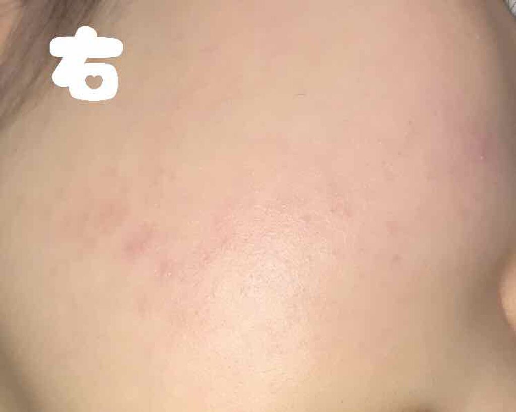 ハトムギ化粧水(ナチュリエ スキンコンディショナー R )/ナチュリエ/化粧水を使ったクチコミ(3枚目)