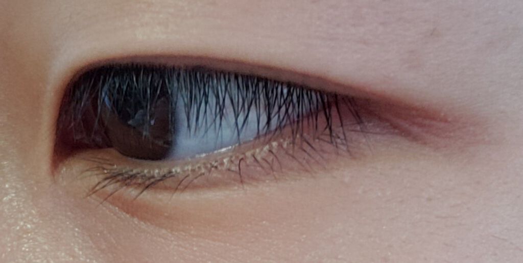 アイトーク/アイトーク/二重まぶた用アイテムを使ったクチコミ（2枚目）