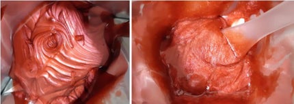 COOK PACK/ETTANG/シートマスク・パックを使ったクチコミ(2枚目)