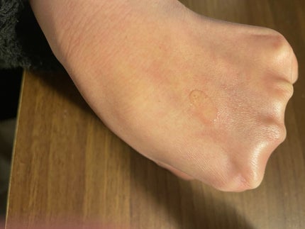 PローションD/DAISO/ミスト状化粧水を使ったクチコミ(4枚目)