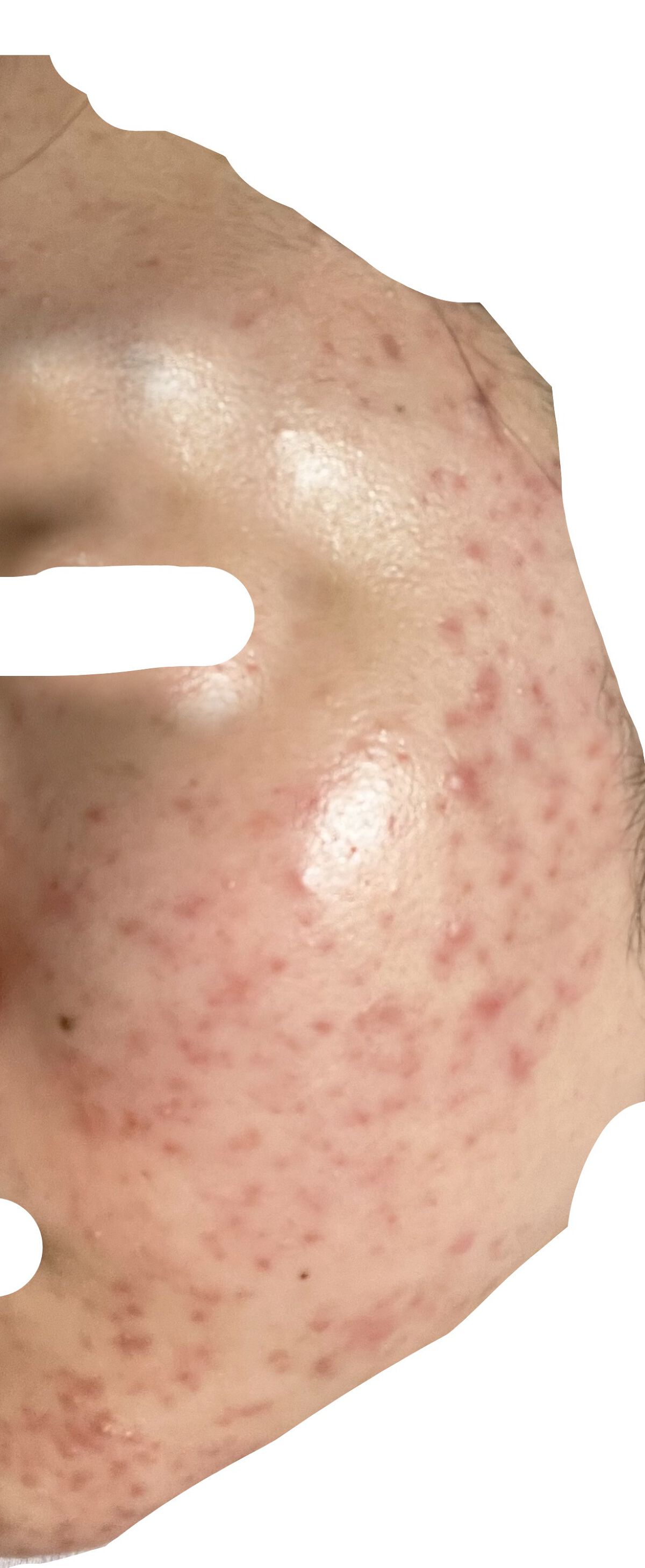 薬用ローション（とてもしっとり）/IHADA/化粧水を使ったクチコミ（3枚目）