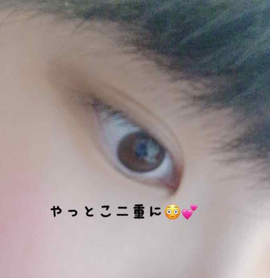 アイトーク/アイトーク/二重まぶた用アイテムを使ったクチコミ（2枚目）
