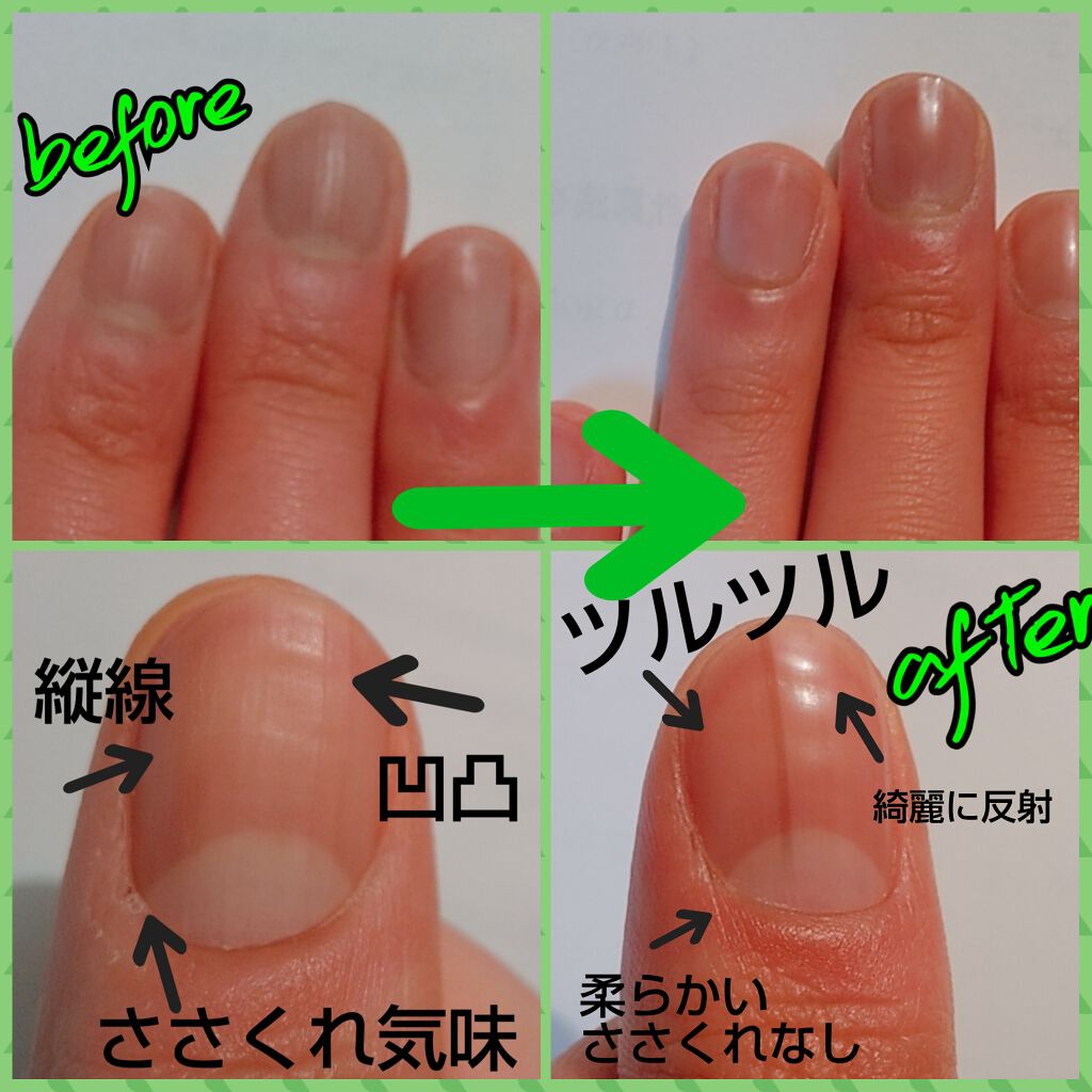 ウィンマックス キューティクルオイル/DAISO/ネイルオイル・トリートメントを使ったクチコミ（2枚目）