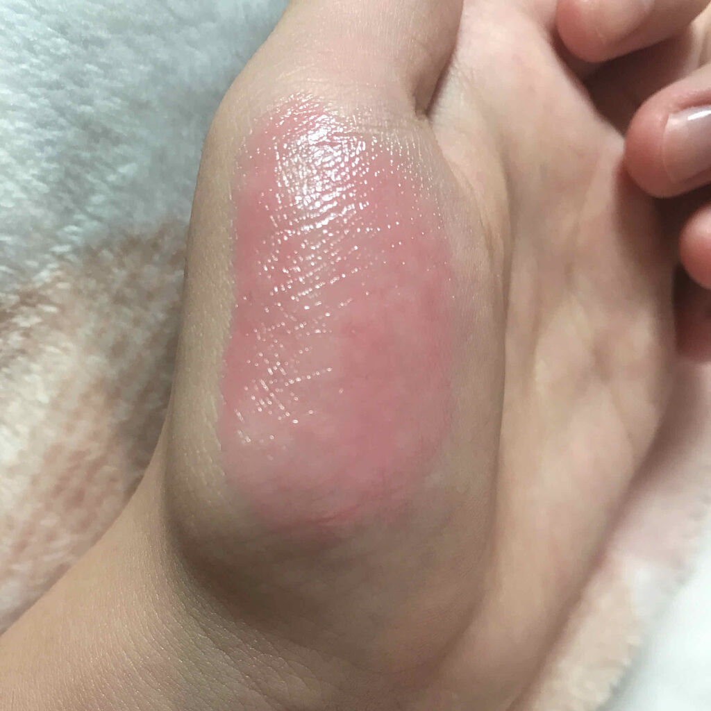 モイストピュアカラーリップ/ニベア/リップクリームを使ったクチコミ（3枚目）