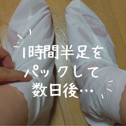 ソフトミネラルフットピーリングパック/MJ-Care/レッグ・フットケアを使ったクチコミ(2枚目)